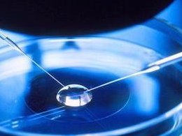 小睾丸症不孕不育（睾丸静脉曲张一定会不孕不育吗）