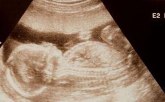 2026绍兴不孕不育医院排名，附成功率及费用介绍