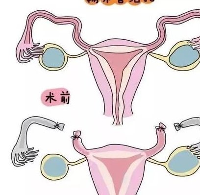 在火箭军特色医学中心做试管婴儿要多少钱？成功率怎么样？附试管怀孕机构名单一览